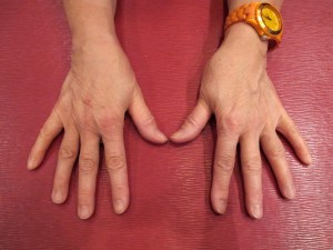 IMG_4418 open view of my hands