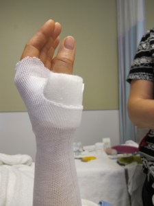 cast time - L stocking sleeve