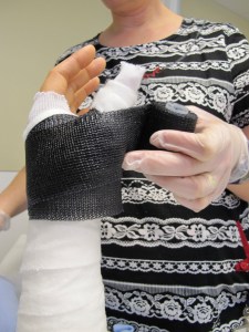 cast time - L fitting around the thumb