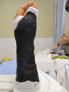 cast time - L cloth folded back on first layer