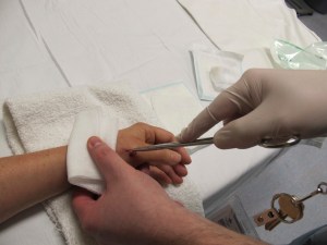 955-cast-2012-02-27 pulling out the pin