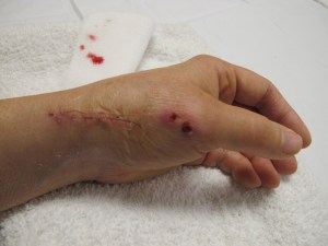 957-cast-2012-02-27 hand without the pin