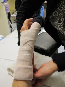 965-cast-2012-02-27 my temporary splint